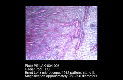 PS-LAK-004-005.png – Radish root, T.S.