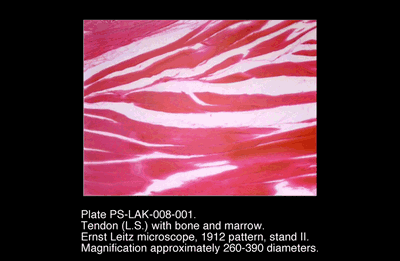 PS-LAK-008-001.png – Tendon (L.S.) with bone and marrow