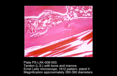 PS-LAK-008-003.png – Tendon (L.S.) with bone and marrow