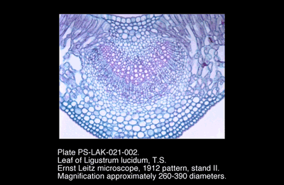 PS-LAK-021-002.png – Leaf of Ligustrum lucidum, T.S.
