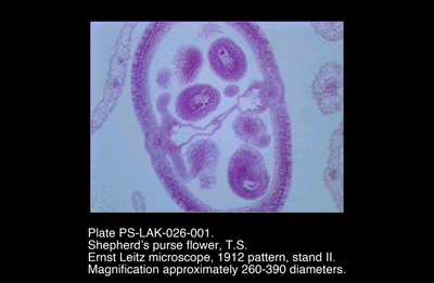 PS-LAK-026-001.png – Shepherd’s purse flower, T.S.