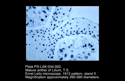 PS-LAK-034-002.png – Mature anther of Lilium, T.S.