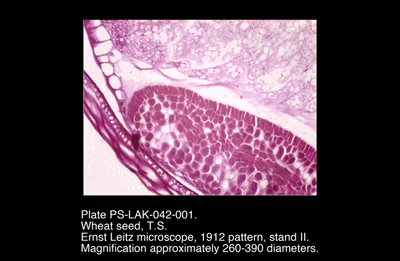 PS-LAK-042-001.png – Wheat seed, T.S.