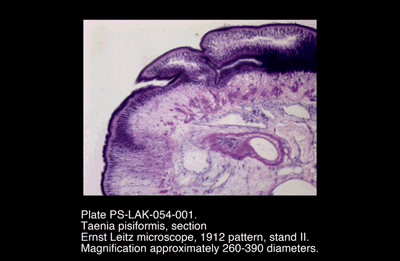 PS-LAK-054-001.png – Taenia pisiformis, section