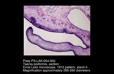 PS-LAK-054-002.png – Taenia pisiformis, section