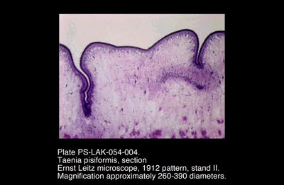 PS-LAK-054-004.png – Taenia pisiformis, section