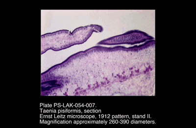 PS-LAK-054-007.png – Taenia pisiformis, section
