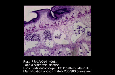 PS-LAK-054-008.png – Taenia pisiformis, section