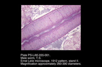 PS-LAK-055-001.png – Male worm, T.S.