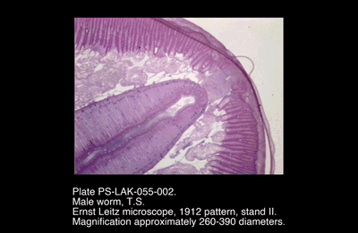 PS-LAK-055-002.png – Male worm, T.S.