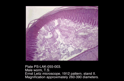 PS-LAK-055-003.png – Male worm, T.S.