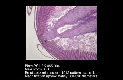 PS-LAK-055-004.png – Male worm, T.S.