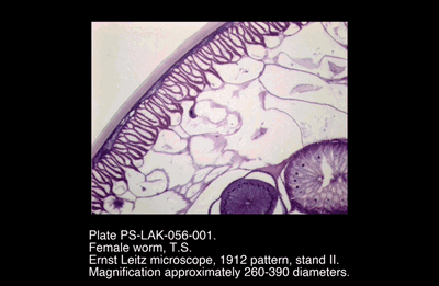 PS-LAK-056-001.png – Female worm, T.S.