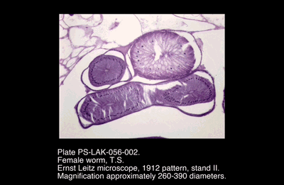 PS-LAK-056-002.png – Female worm, T.S.