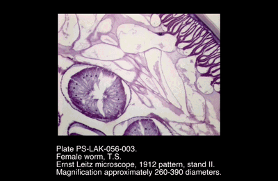 PS-LAK-056-003.png – Female worm, T.S.