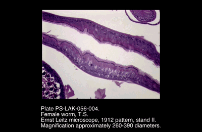 PS-LAK-056-004.png – Female worm, T.S.