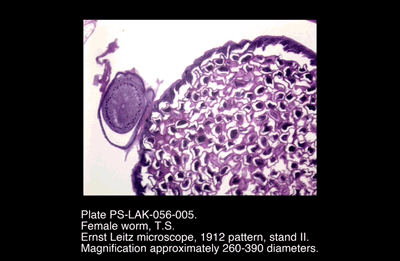 PS-LAK-056-005.png – Female worm, T.S.