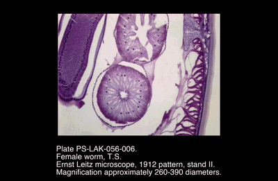 PS-LAK-056-006.png – Female worm, T.S.