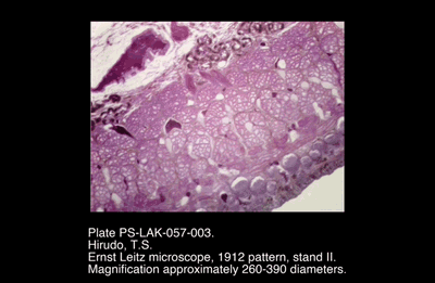 PS-LAK-057-003.png – Hirudo, T.S.