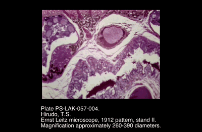 PS-LAK-057-004.png – Hirudo, T.S.