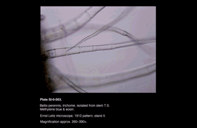 SI-0-003.png – Bellis perennis, trichome, isolated from stem T.S.