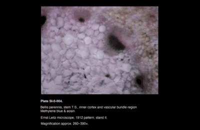 SI-0-004.png – Bellis perennis, stem T.S., inner cortex and vascular bundle region