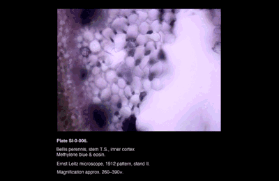 SI-0-006.png – Bellis perennis, stem T.S., inner cortex