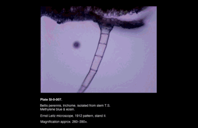 SI-0-007.png – Bellis perennis, trichome, isolated from stem T.S.