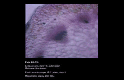 SI-0-012.png – Bellis perennis, stem T.S, outer region