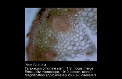 SI-II-031.png – Taraxacum officinale stem, T.S., focus merge