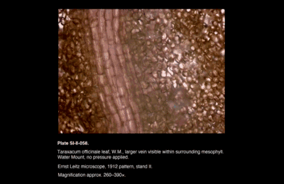 SI-II-058.png – Taraxacum officinale leaf, W.M., larger vein visible within surrounding mesophyll