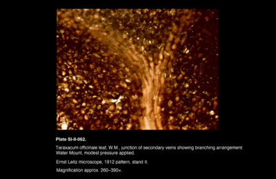 SI-II-062.png – Taraxacum officinale leaf, W.M., junction of secondary veins showing branching arrangement