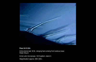 SI-IV-004.png – Urtica dioica leaf, W.M., stinging hairs arising from bulbous base