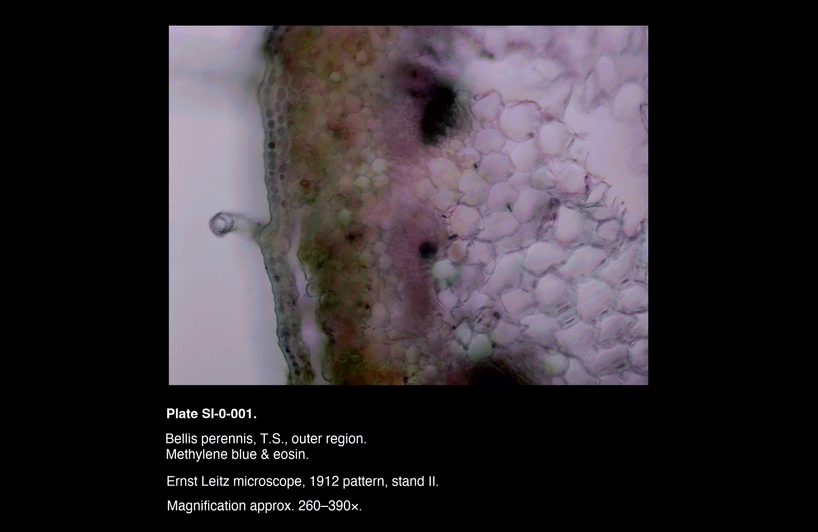 SI-0-001.png – Bellis perennis, T.S.