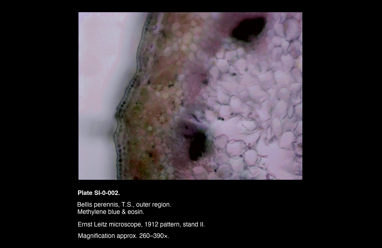 SI-0-002.png – Bellis perennis, T.S.