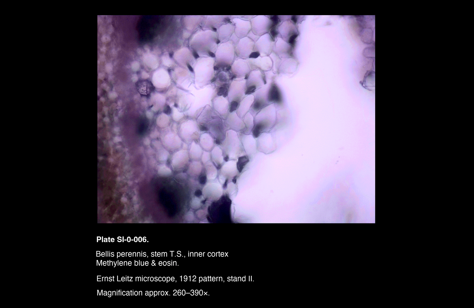 SI-0-006.png – Bellis perennis, stem T.S., inner cortex