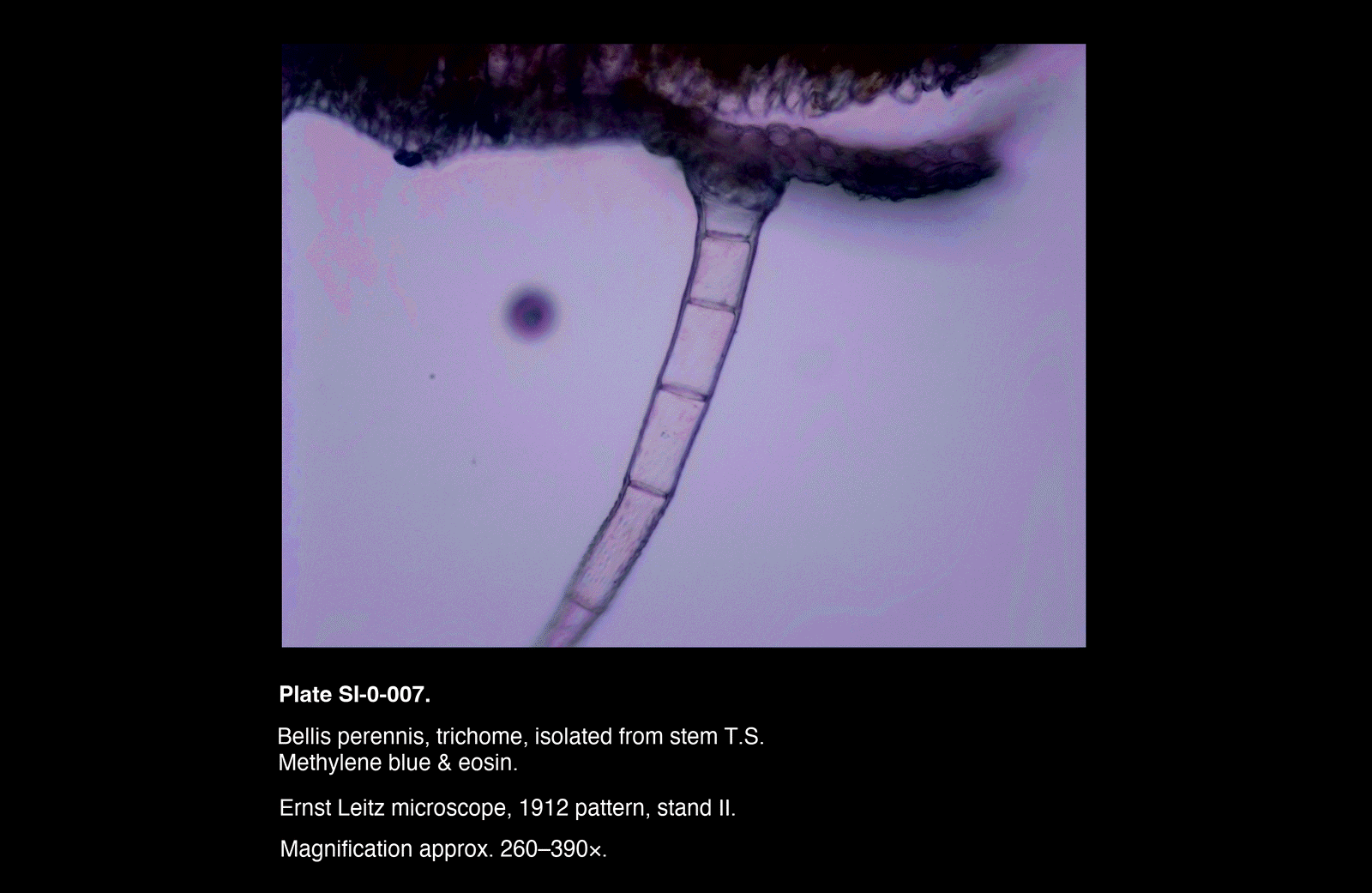 SI-0-007.png – Bellis perennis, trichome, isolated from stem T.S.