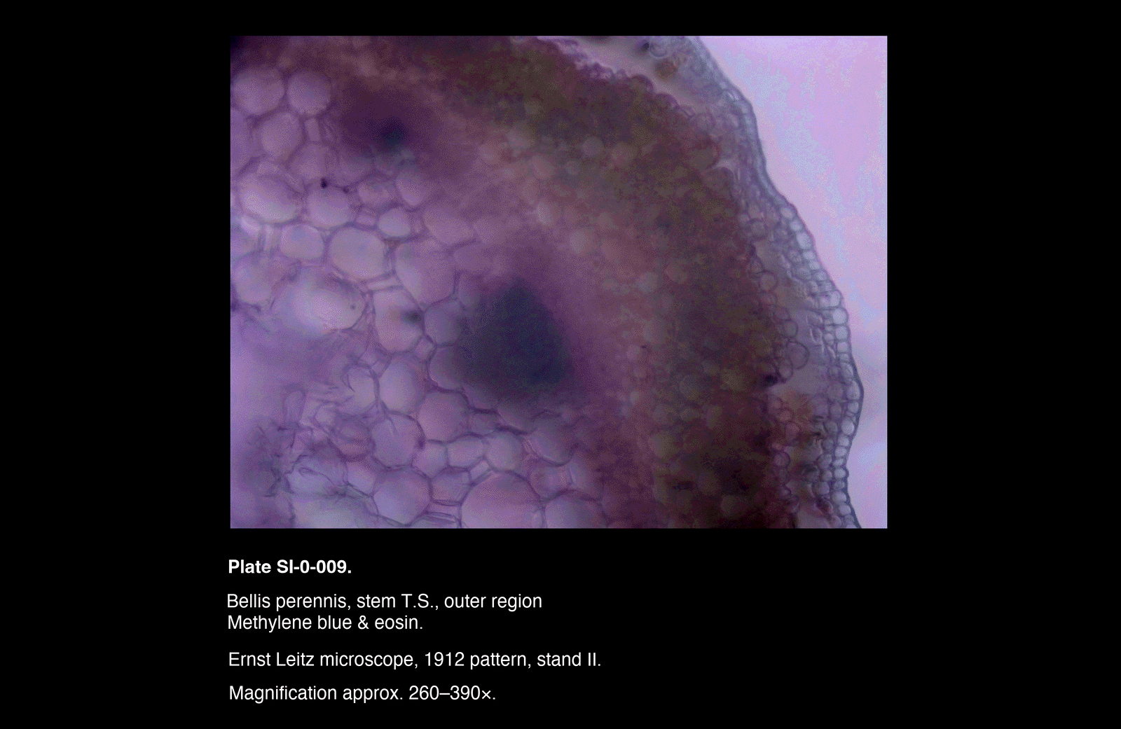 SI-0-009.png – Bellis perennis, stem T.S., outer region