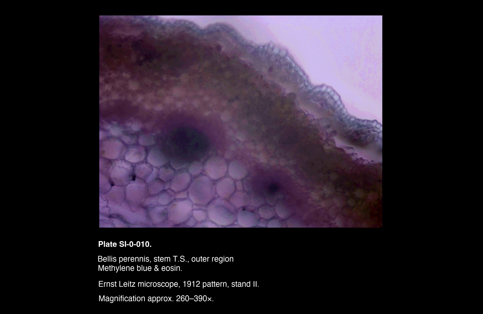SI-0-010.png – Bellis perennis, stem T.S., outer region