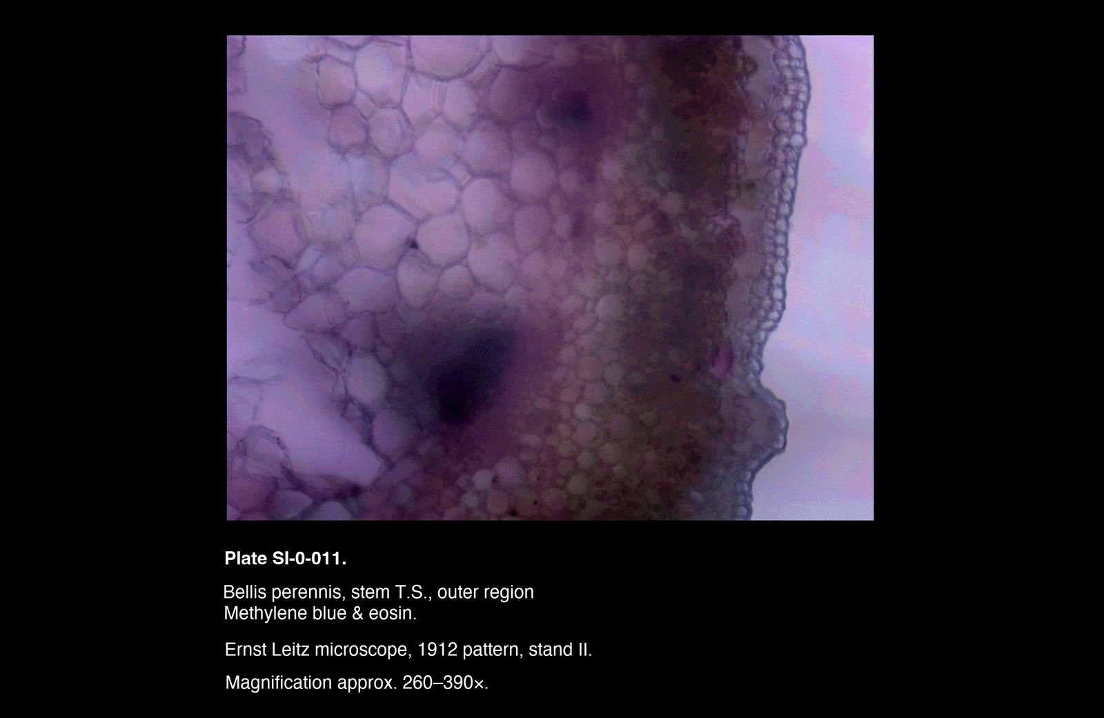 SI-0-011.png – Bellis perennis, stem T.S, outer region
