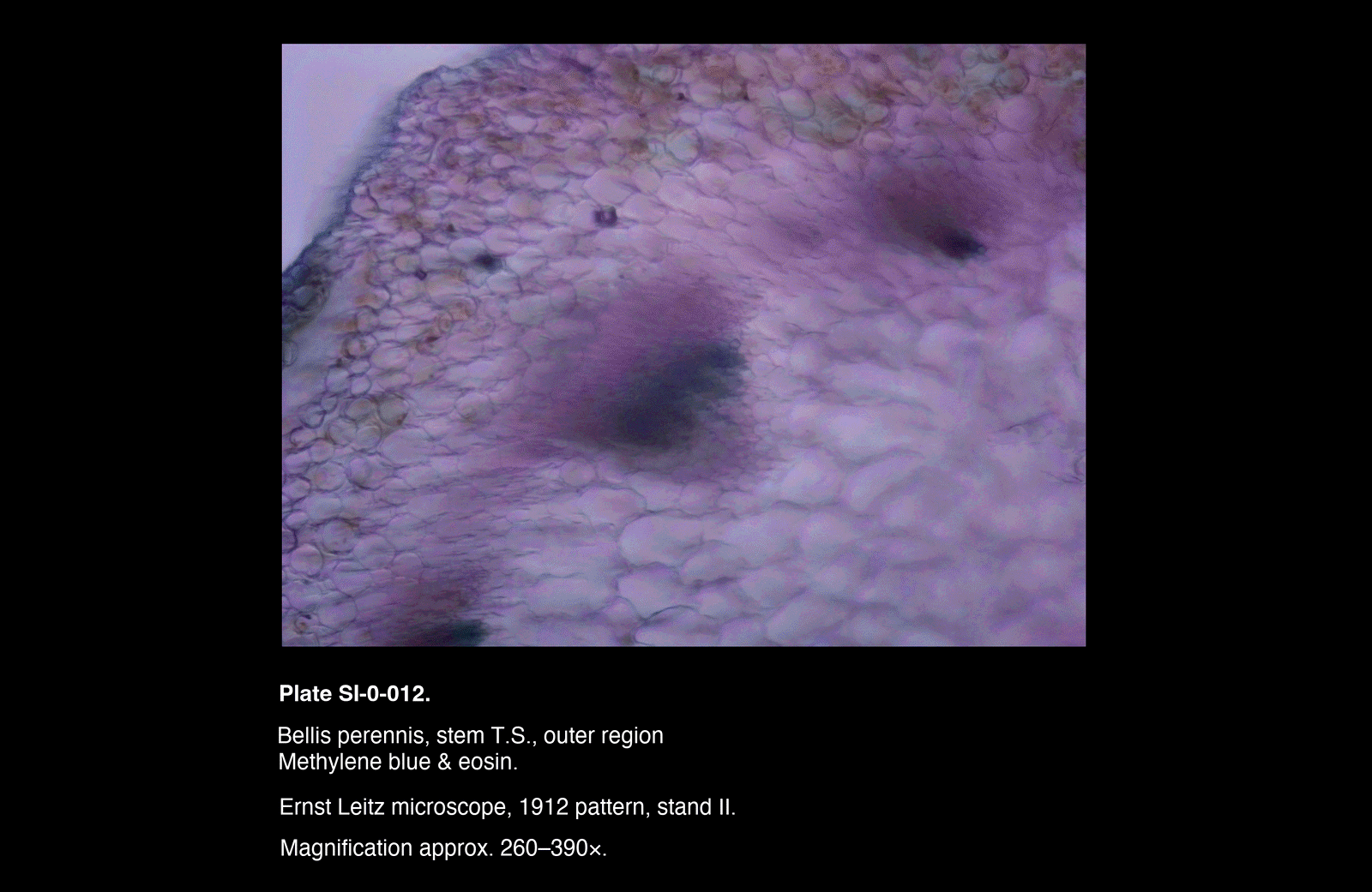 SI-0-012.png – Bellis perennis, stem T.S, outer region