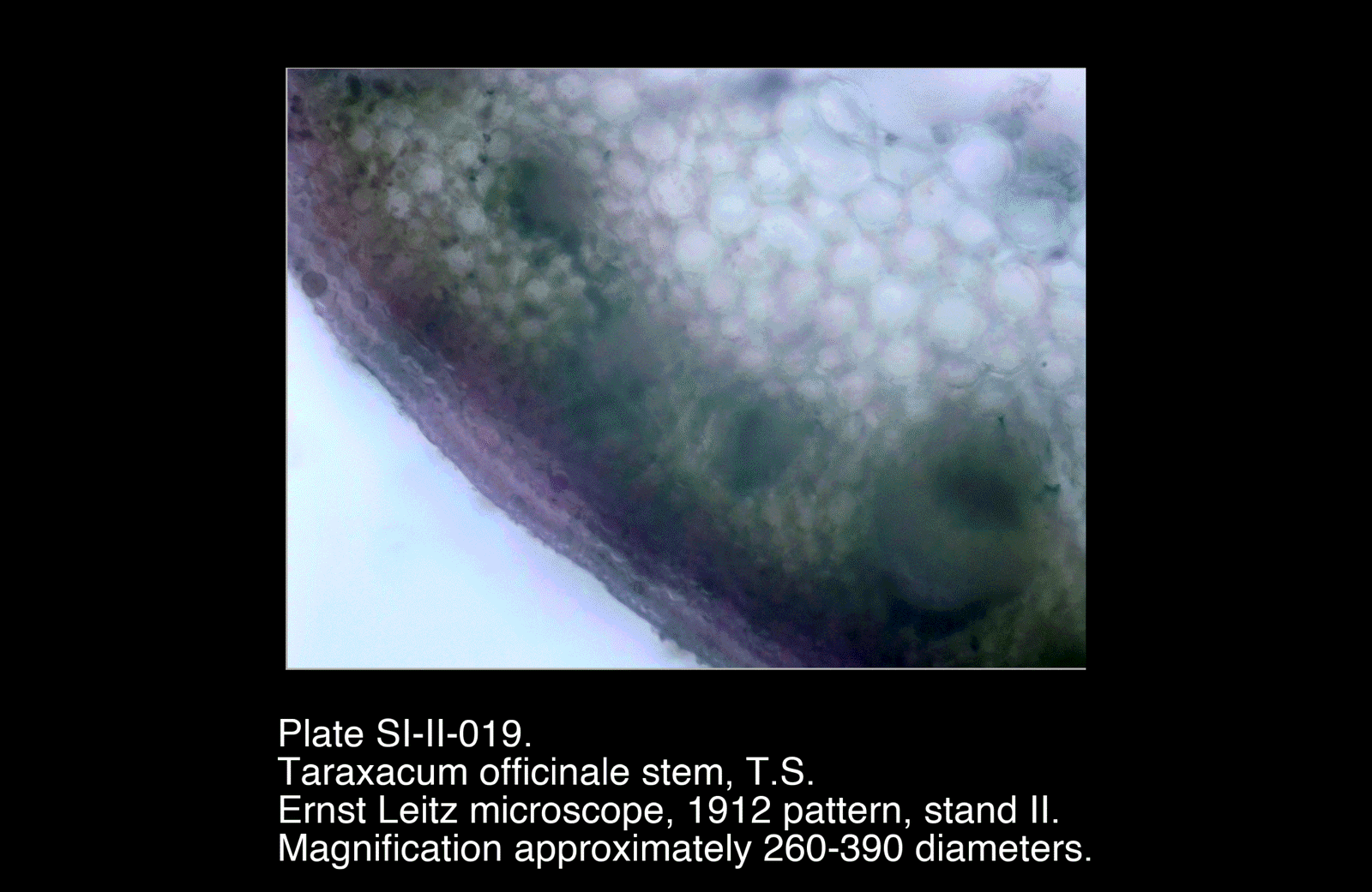 SI-II-019.png – Taraxacum officinale stem, T.S.