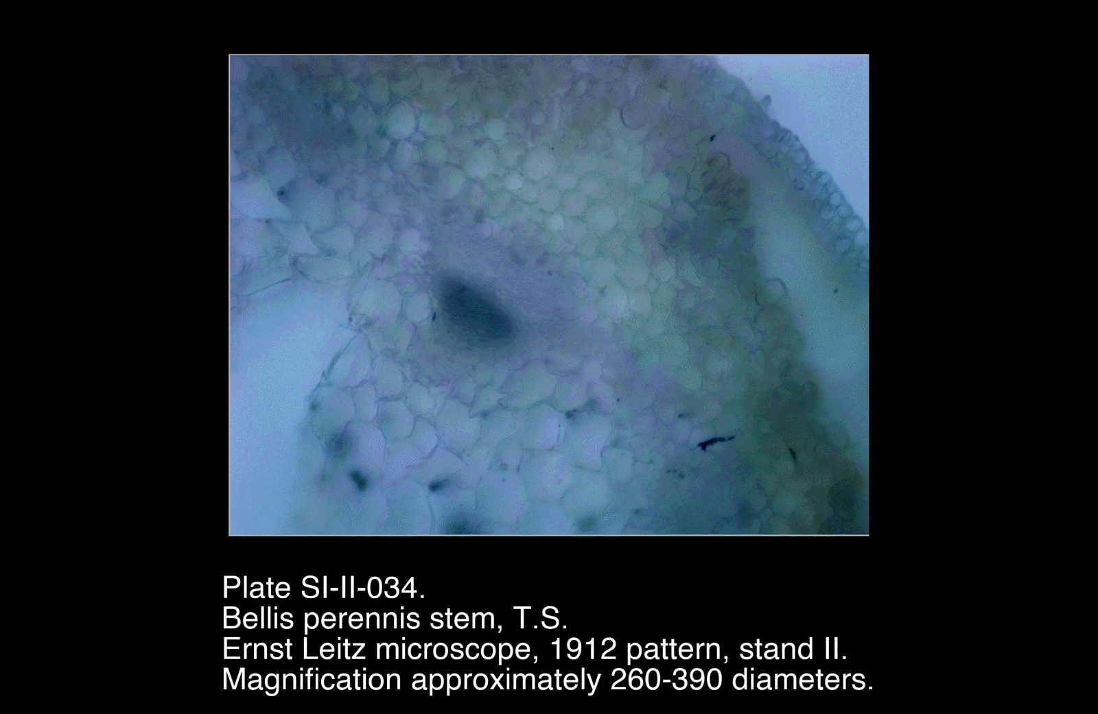 SI-II-034.png – Bellis perennis stem, T.S.