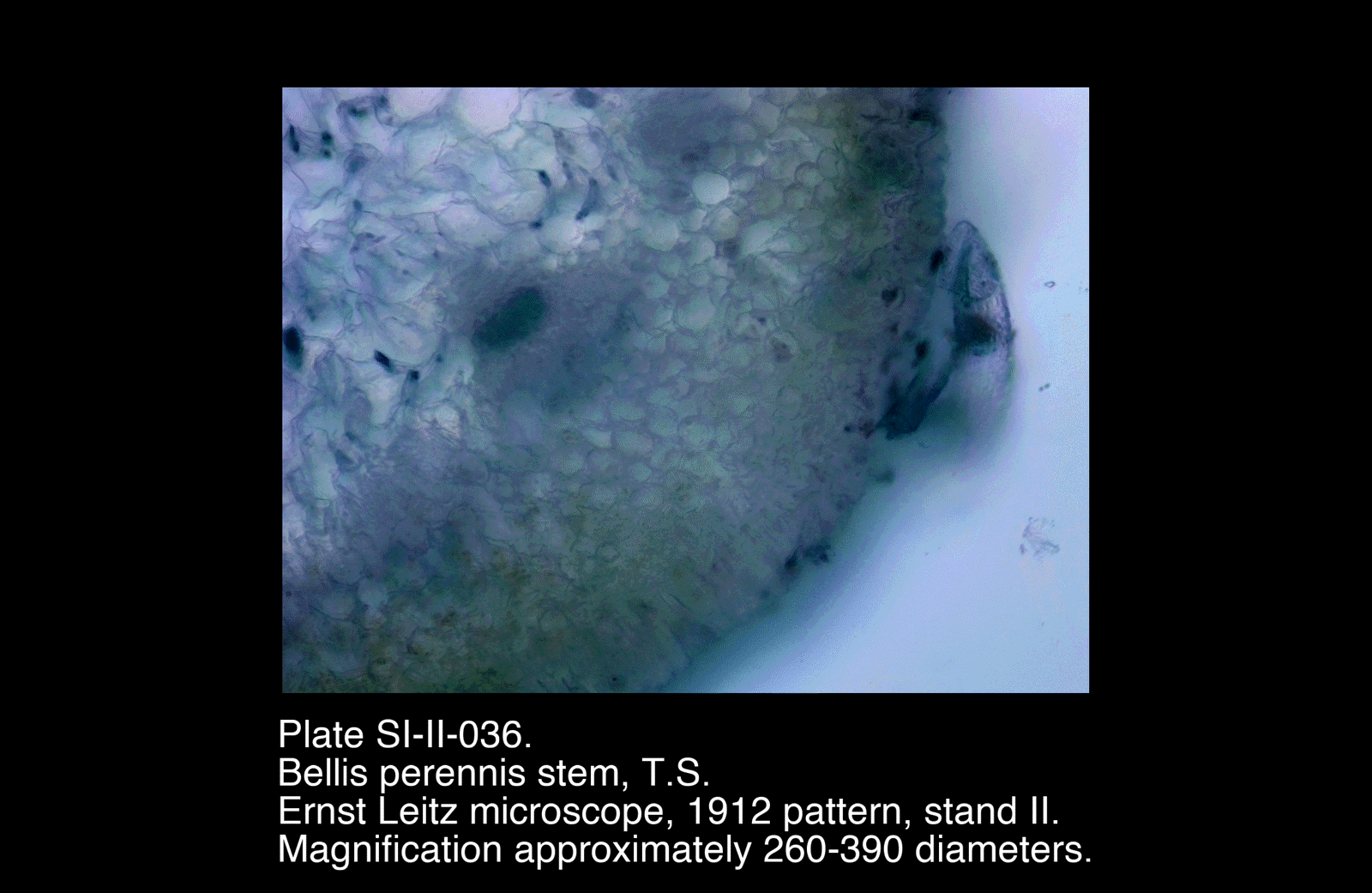 SI-II-036.png – Bellis perennis stem, T.S.