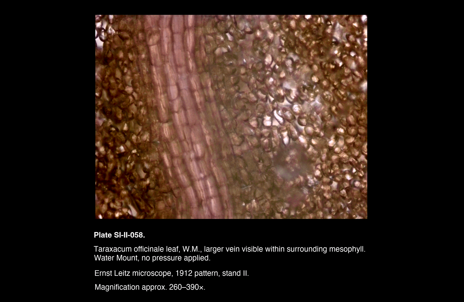 SI-II-058.png – Taraxacum officinale leaf, W.M., larger vein visible within surrounding mesophyll