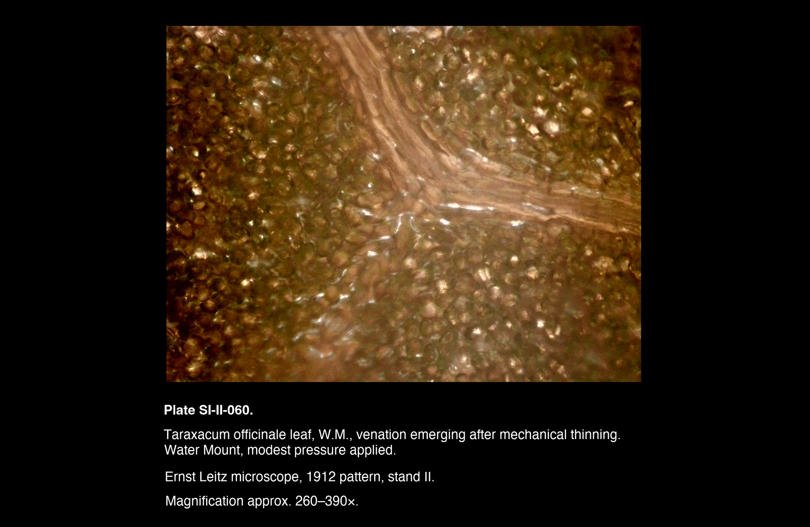 SI-II-060.png – Taraxacum officinale leaf, W.M., venation emerging after mechanical thinning