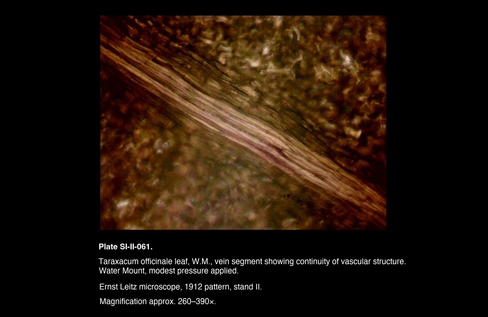 SI-II-061.png – Taraxacum officinale leaf, W.M., vein segment showing continuity of vascular structure