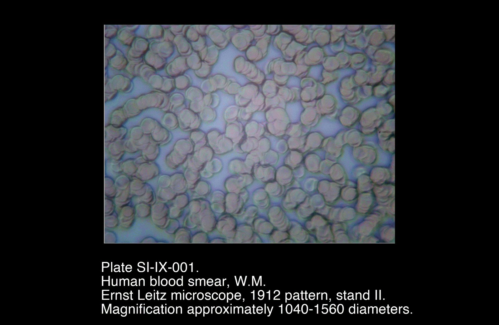 SI-IX-001.png – Human Blood Smear, W.M.