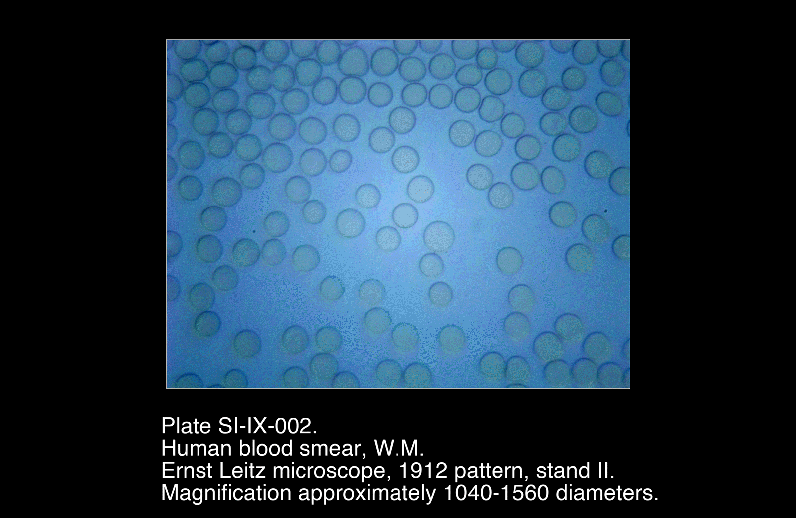 SI-IX-002.png – Human Blood Smear, W.M.